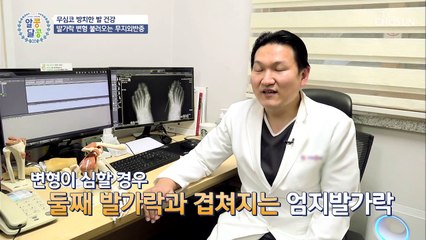 발이 보내는 적신호 무지무지하게 아픈 무지외반증 TV CHOSUN 20211209 방송