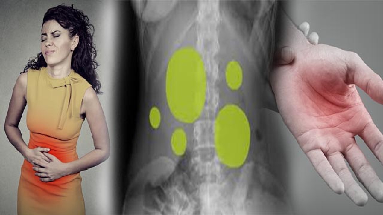 गैस का दर्द कहां कहां होता है Gas Ka Dard Kahan Hota Hai Boldsky