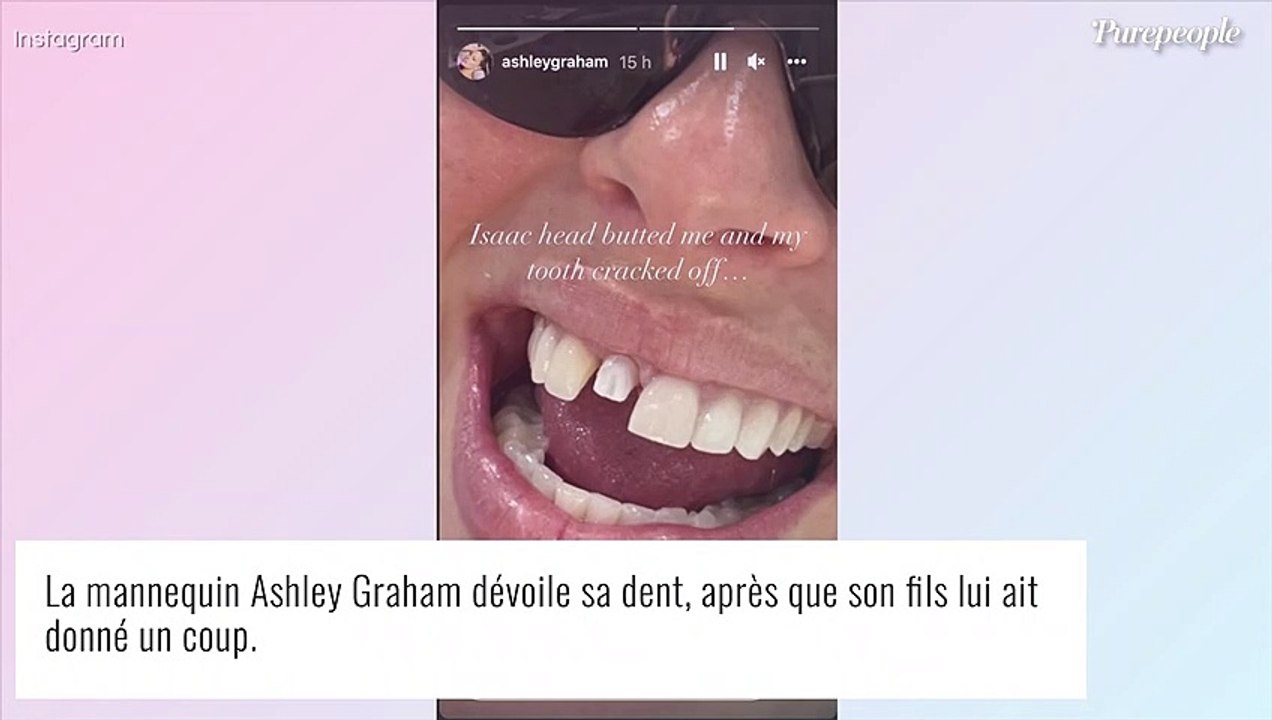 Ashley Graham blessée par son fils, son visage bien amoché !