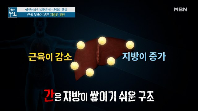 근육 부족이 지방간 부른다? 근육 합성 돕는 단백질 섭취법