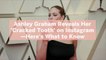 Ashley Graham Reveals Her 'Cracked Tooth' on Instagram—Here's What to Know