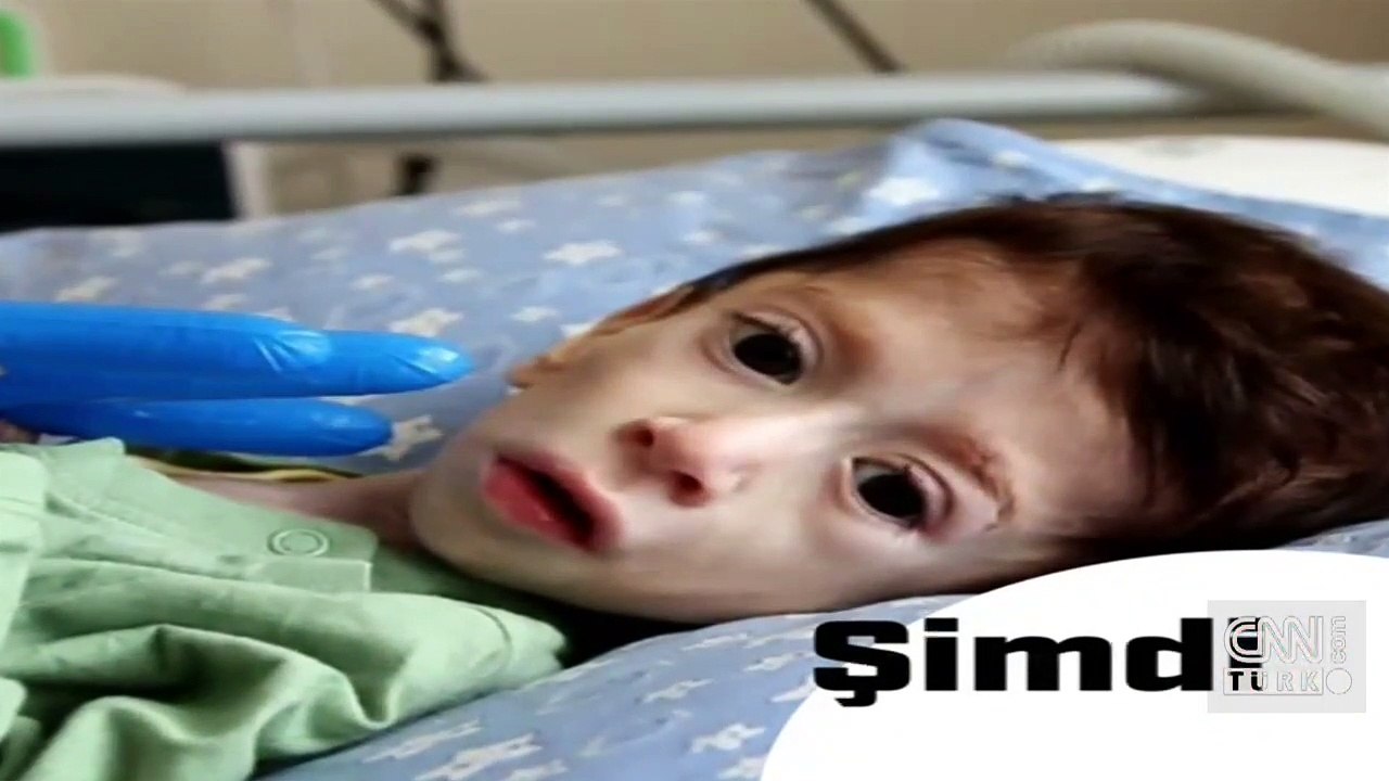 SMA’lı Ensar bebek destek bekliyor