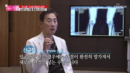 절뚝이며 걸었던 순월 엄마의 시술 후 놀라운 변화 TV CHOSUN 20211212 방송