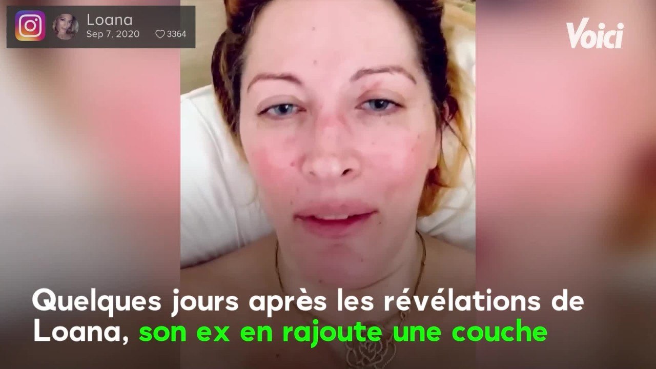 VOICI Loana giflée par Fred Cauvin : pourquoi elle a elle aussi été placée en garde à vue après avoir appelé la police