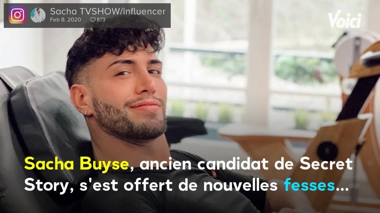 Voici -Secret Story 8 : Sacha Buyse s'offre de nouvelles fesses et diffuse l'opération sur Instagram