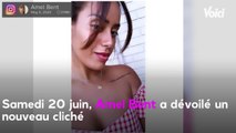 VOICI - PHOTO Amel Bent accusée d’avoir abusé de la retouche, elle est défendue par ses fans