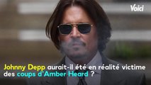 VOICI Procès de Johnny Depp : Amber Heard violente ? Les photos du visage tuméfié de l'acteur dévoilées