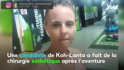 Voici - PHOTO Koh-Lanta 2020 : une candidate révèle avoir fait de la chirurgie esthétique après l'aventure