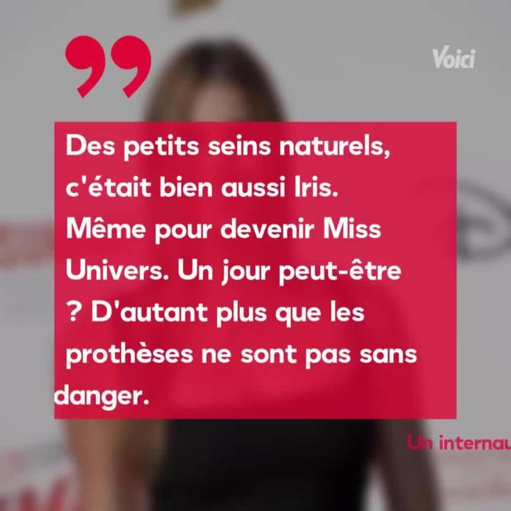 Copy of: VOICI - Iris Mittenaere accusée d'avoir eu recours à la chirurgie esthétique, elle recadre un internaute