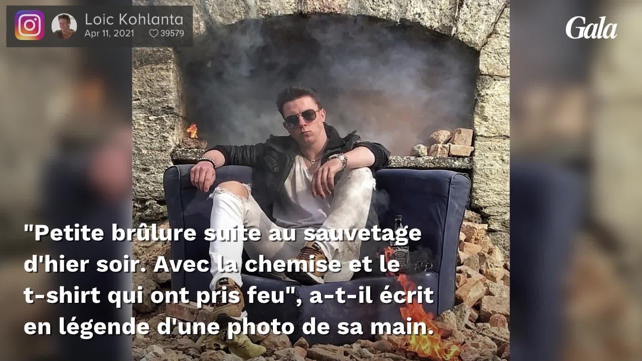 GALA VIDEO - PHOTO - Loïc (Koh-Lanta) gravement brûlé : il dévoile l'impressionnante blessure