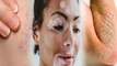 Vitamins की कमी Skin Problems का कारण, Ageing से लेकर Vitiligo तक का खतरा | Boldsky