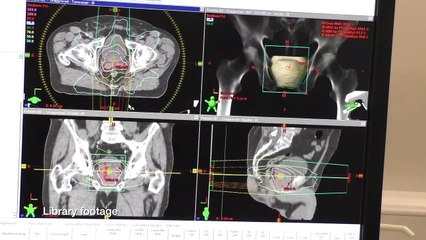Cancer patients could be missing out on vital treatment during the Covid 19 outbreak