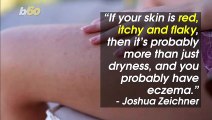 How to Tell If You Have Dry Skin or Eczema?