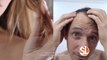 enVoqueMD Personalized Wellness: Relationship between hair loss and your thyroid