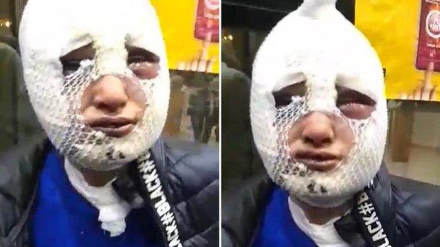Eski sözlüsünün başından aşağı kızgın yağ döktü: Tutuklandı