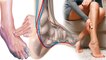 धमनी रोग क्या है | धमनी रोग के लक्षण | Peripheral Artery Disease In Legs Hindi | Boldsky