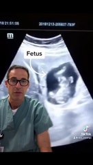 அடடே.. இப்படியும் நடக்குமா.. பெண் உடம்பில் கரு எங்கே வளர்ந்திருக்கு பாருங்க!