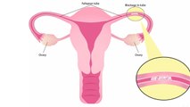 फैलोपियन ट्यूब खोलने का सबसे आसान तरीका ,प्रेगनेंसी में नहीं आएगी कोई दिक्कत । Boldsky