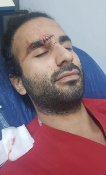 Alkollü geldiği hastanede doktora kafa atıp kaşını yardı