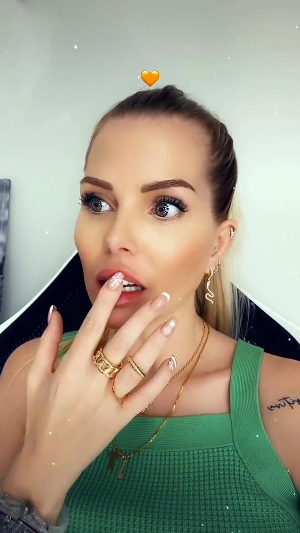 Jessica Thivenin surnommée "bouche tordue" après d'énièmes injections aux  lèvres - Vidéo Dailymotion