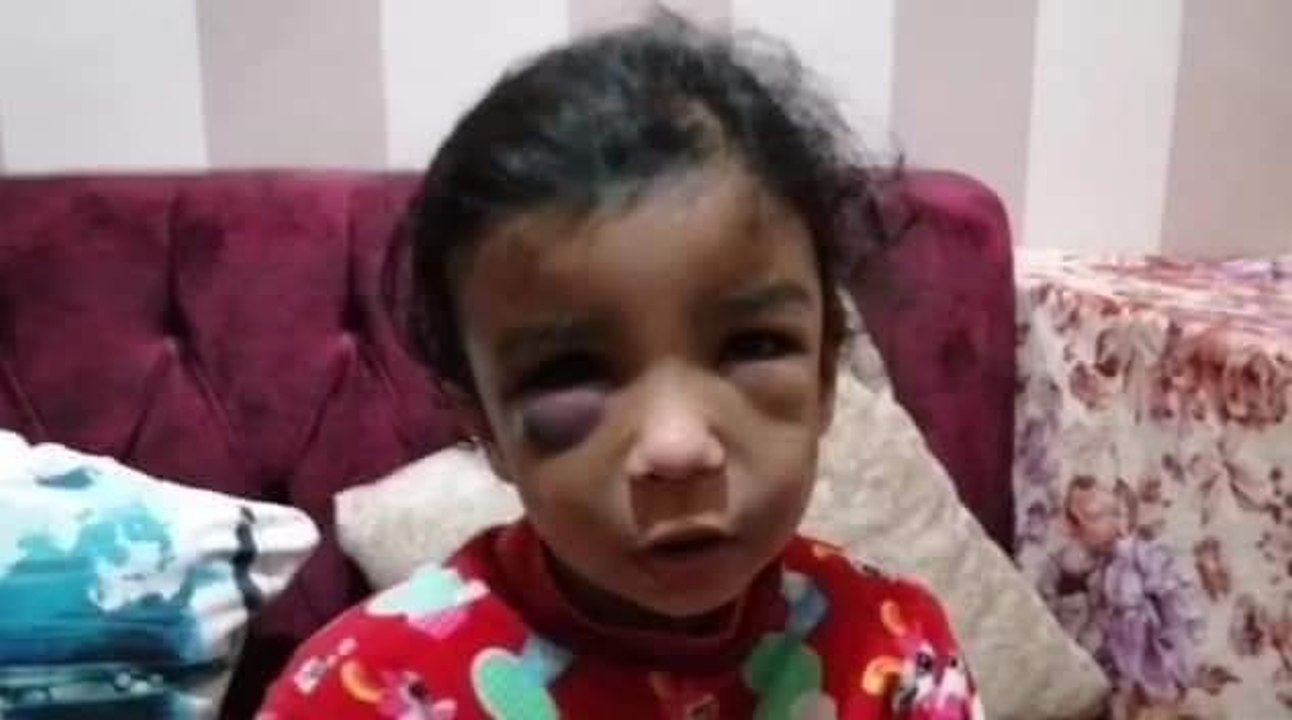 (الطفلة رودينا) النيابة حبست أب لإنه ضرب بنته ضرب مبرح (شوف عمل إيه في البنت).. صبري عثمان رئيس وحدة نجدة الطفل بالقومي للأمومة والطفولة يوضح التفاصيل