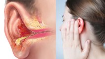 सर्दी में कान दर्द क्यों होता है, कारण और कैसे करें बचाव | Boldsky