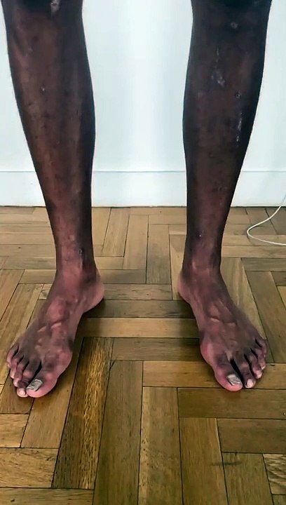 Laurent Maistret partage sa silhouette après le tournage de "Koh-Lanta, La Légende". Il a "bien morflé" !