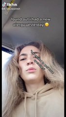 Una 'tiktoker' muestra la fuerte reacción alérgica