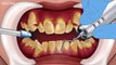 ASMR - Amazing braces animation - Oddly Satisfying - Dental care