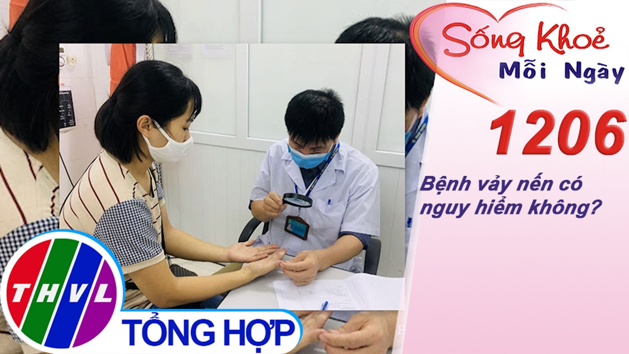 Bệnh vảy nến có nguy hiểm không? ​| Sống khỏe mỗi ngày - Kỳ 1206