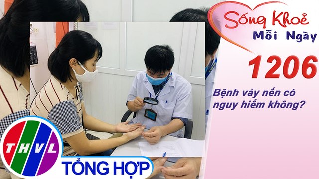 Bệnh vảy nến có nguy hiểm không? ​| Sống khỏe mỗi ngày - Kỳ 1206