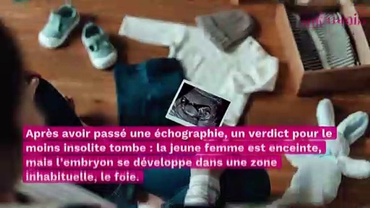 Grossesse extra-utérine : une femme apprend que son fœtus se développe dans son foie