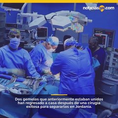 Siameses son separados tras compleja cirugía