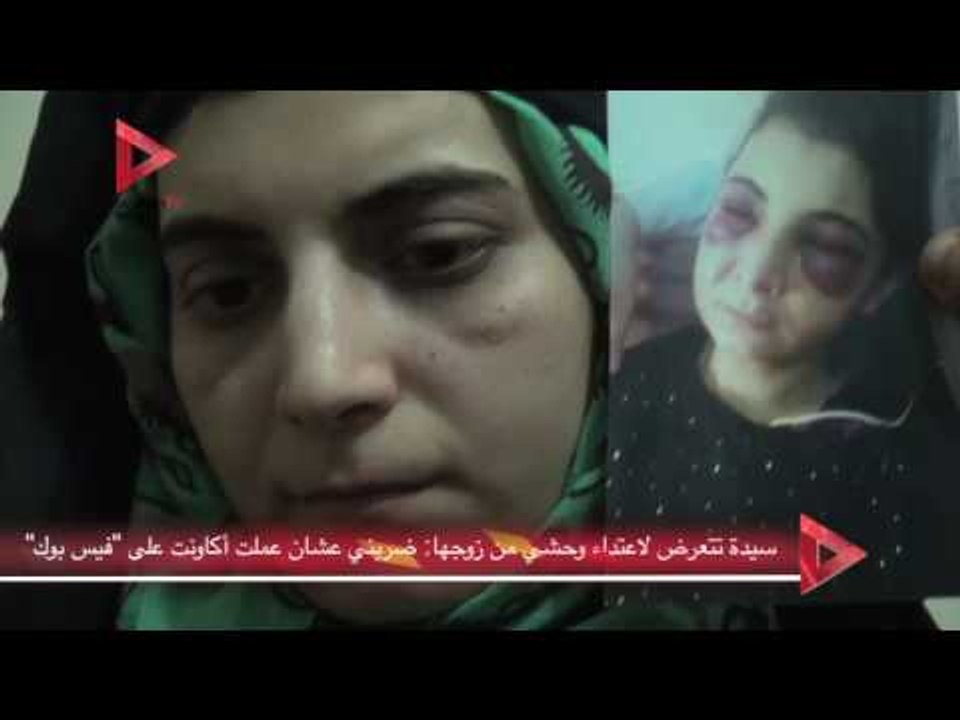 سيدة تتعرض لاعتداء وحشي من زوجها: ضربني عشان عملت أكاونت على فيس بوك