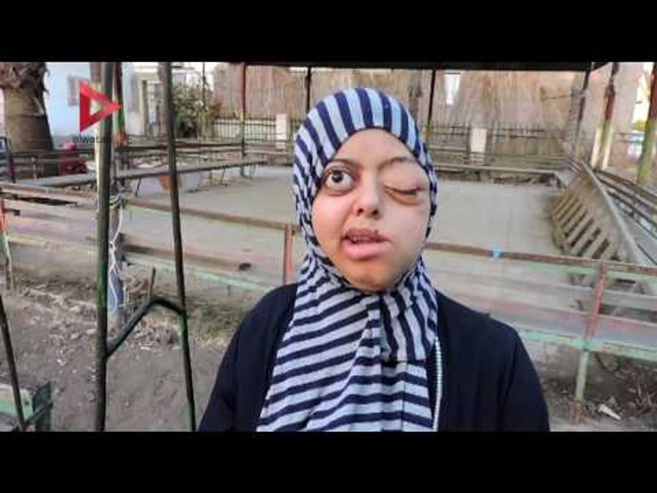 "إيمان" فتاة مصابة بورم نادر في العين: أنا ضحية...