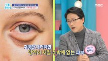 [HEALTHY] Early removal of fat under the eyes will lead to 