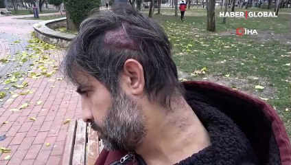 12 yılda gitmedik hastane bırakmadı! Başında çıkan kiste teşhis konulamıyor