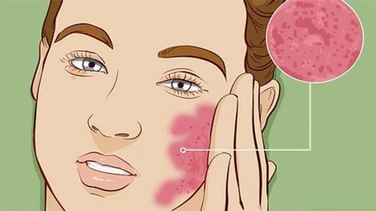 चेहरे पर दूध लगाने के नुकसान | Chehre Par Doodh Lagane Ke Nuksan | Boldsky