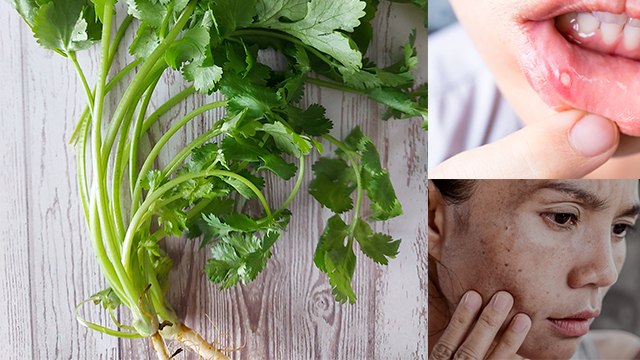 धनिया के डंठल खाने से क्या होता है, Mouth Ulcer से लेकर Cancer तक का खतरा | Boldsky