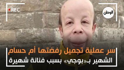 سر عملية تجميل رفضتها أم حسام الشهير بـ«بوجي» بسبب فنانة شهيرة