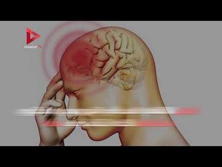 تعرف على أعراض فيروس الالتهاب السحائي