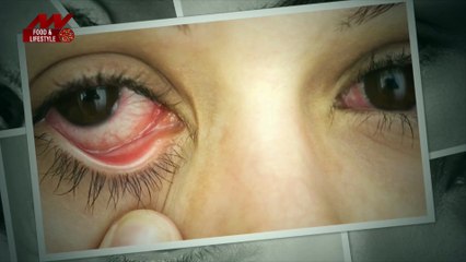 आंखों की सूजन को ऐसे करें कम, करें ये खास उपाय