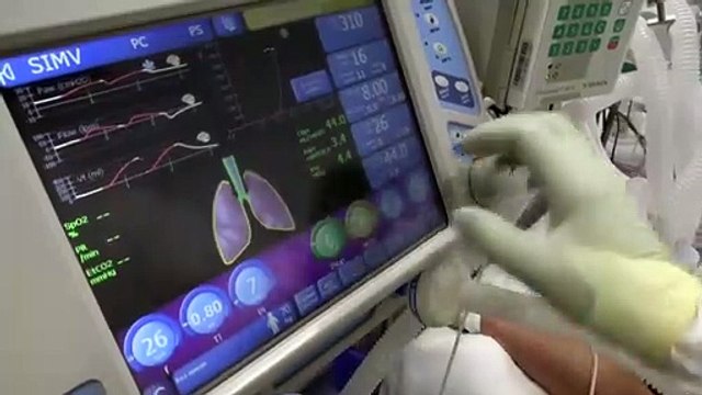 Темпы заражения коронавирусом в России снижаются