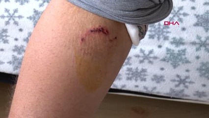 SULTANGAZİ'DE PİTBULL'UN SALDIRDIĞI MUHAMMED SAHİBİ TUT DEYİNCE SALDIRDI