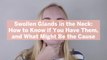 Swollen Glands in the Neck: How to Know if You Have Them, and What Might Be the Cause