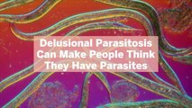 Delusional Parasitosis Can Make People Think They Have Parasites—What to Know About the Ps