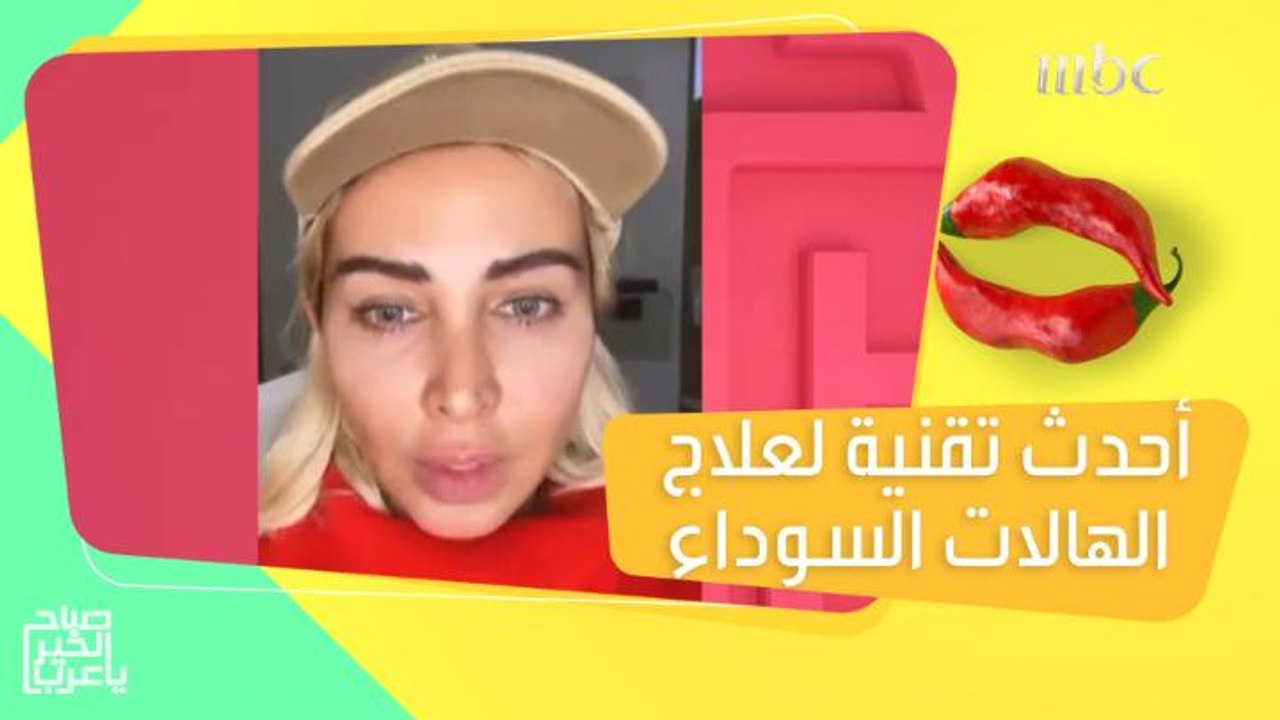 التقنية التي طبقتها جويل مردينيان لإزالة الخطوط والهالات السوداء تحت عينيها!