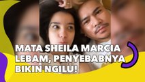 Mata Sheila Marcia Mendadak Lebam, Penyebabnya Bikin Ngilu!