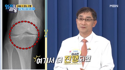 참을 수 없는 고통! 관절 통증의 원인은?