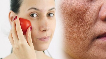 कच्चा टमाटर चेहरे पर से क्या होता है, Pimples से लेकर Jhaiyan तक गायब | Boldsky